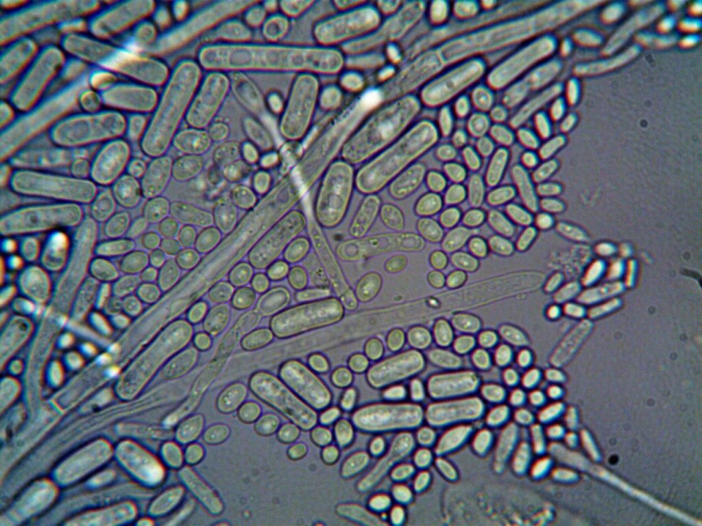 Micróbio escocês rompe o próprio corpo para liberar células-filhas Imagem microscópica de microrganismos em alta ampliação